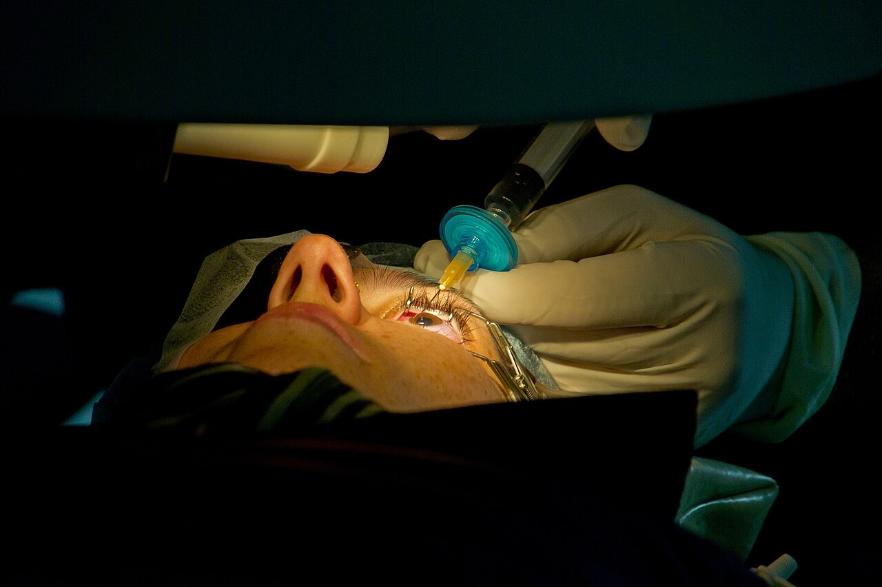 Cirurgia LASIK sendo realizada em centro cirúrgico